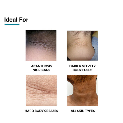 Fixderma Skincare Lactic Acid Fidelia Moisturizing Cream For Dry Skin